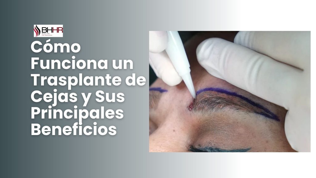 trasplante de cejas